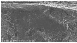 圖11-154 斷面A1、A2區(qū)邊沿微觀形貌
